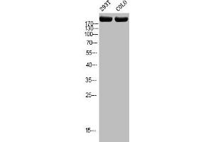 Western blot analysis of 293T COLO using p-Topo IIα (T1343) antibody. (Topoisomerase II alpha antibody  (pSer1343))