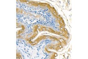 Immunohistochemistry of paraffin embedded rat stomach using CK13 (ABIN7074411) at dilution of 1:1200 (400x lens) (Cytokeratin 13 antibody  (C-Term))