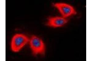 Immunofluorescent analysis of DCLK2 staining in HepG2 cells.