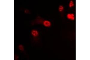 Immunofluorescent analysis of P2X4 staining in U2OS cells. (P2RX4 antibody)