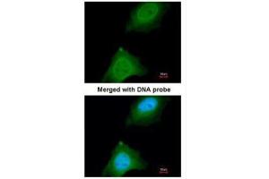 ICC/IF Image Immunofluorescence analysis of paraformaldehyde-fixed HeLa, using ASB9, antibody at 1:200 dilution. (ASB9 antibody)