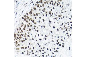Immunohistochemistry (IHC) image for anti-Small Nuclear Ribonucleoprotein Polypeptide A (SNRPA) (AA 1-220) antibody (ABIN6148212)