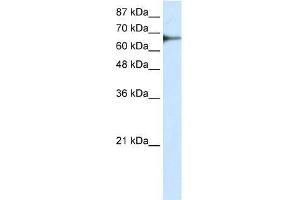 Transfected 293T; WB Suggested Anti-L3MBTL2 Antibody Titration: 0. (L3MBTL2 antibody  (C-Term))