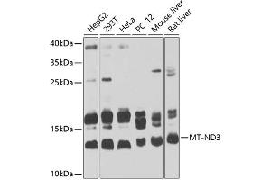 Western blot analysis of extracts of various cell lines, using MT-ND3 Antibody (ABIN6135087, ABIN6144109, ABIN6144110 and ABIN6225270) at 1:1000 dilution.