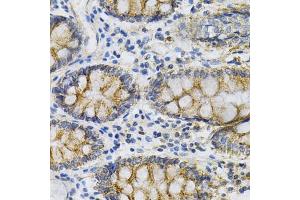 Immunohistochemistry of paraffin-embedded human colon using PTPRA Antibody (ABIN3015783, ABIN3015784, ABIN1682399 and ABIN6219134) at dilution of 1:100 (40x lens). (PTPRA antibody  (AA 20-142))