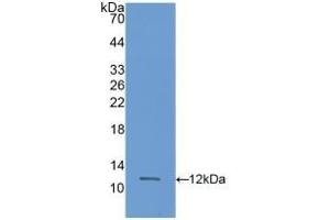 Detection of Recombinant S100A11, Rat using Polyclonal Antibody to S100 Calcium Binding Protein A11 (S100A11) (S100A11 antibody  (AA 9-98))