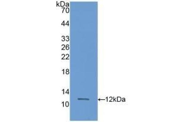 S100A11 antibody  (AA 9-98)