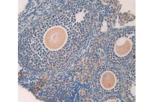 IHC-P analysis of ovary tissue, with DAB staining.