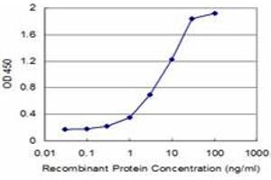 Detection limit for recombinant GST tagged KLF5 is approximately 0. (KLF5 antibody  (AA 358-457))