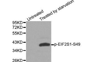 Western blot analysis of extracts from Hela cells, using phospho-EIF2S1-S49 antibody. (EIF2S1 antibody  (pSer49))