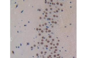 Used in DAB staining on fromalin fixed paraffin- embedded Kidney tissue (FOXP1 antibody  (AA 122-346))