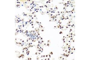Immunohistochemistry (Paraffin-embedded Sections) (IHC (p)) image for anti-Splicing Factor Proline/glutamine-Ric (SFPQ) (AA 578-707) antibody (ABIN1513519)