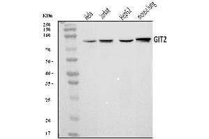 Western blot analysis of GIT2 using anti-GIT2 antibody (ABIN7601655).