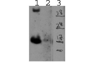 Lane 1 - mIL15 transfectant; Lane 2 - Control; Lane 3 - Marker (IL-15 antibody)