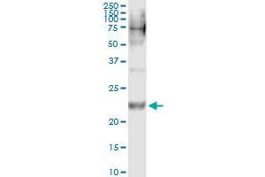Immunoprecipitation of WISP2 transfected lysate using anti-WISP2 monoclonal antibody and Protein A Magnetic Bead , and immunoblotted with WISP2 MaxPab rabbit polyclonal antibody. (WISP2 antibody  (AA 24-250))