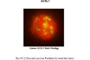 Researcher: Received from anonymousApplication: IHCSpecies+tissue/cell type: THP-1 derived macrophage activated with iMtb Primary Antibody dilution: Primary ab dil: 1:200Secondary Antibody: Goat anti-rabbit Alexa Fluor 647 Secondary Antibody Dilution: 1:033 (ACSL1 antibody  (N-Term))