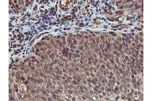 Image no. 9 for anti-V-Akt Murine Thymoma Viral Oncogene Homolog 1 (AKT1) antibody (ABIN1496557) (AKT1 antibody)