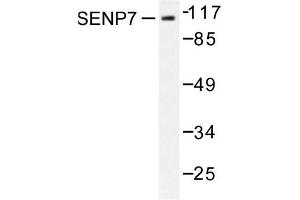 Image no. 1 for anti-SUMO1/sentrin Specific Protease 7 (SENP7) antibody (ABIN271960) (SENP7 antibody)
