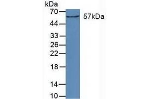 Detection of CYP27B1 in Mouse Kidney Tissue using Polyclonal Antibody to Cytochrome P450 27B1 (CYP27B1) (CYP27B1 antibody  (AA 256-508))