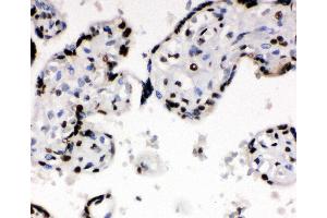 Anti-Ku70 antibody, IHC(P) IHC(P): Human Placenta Tissue