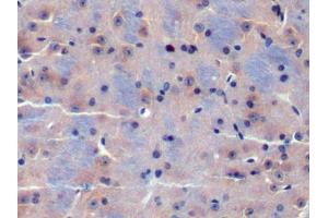 DAB staining on IHC-P; Samples: Mouse Cerebrum Tissue (CDK18 antibody  (AA 121-402))