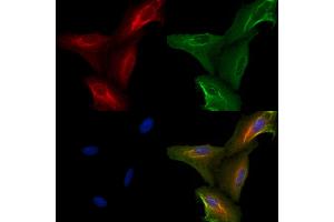 ABIN6264768 and ABIN6272617 staining  cells by IF/ICC.