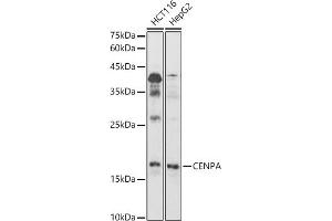 Western blot analysis of extracts of various cell lines, using CENPA antibody (ABIN7266271) at 1:1000 dilution. (CENPA antibody  (AA 1-100))