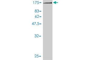 Western Blot detection against Immunogen (125. (GTF3C2 antibody  (AA 1-911))