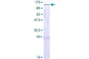 Image no. 1 for SATB Homeobox 2 (SATB2) protein (GST tag) (ABIN1319179) (SATB2 Protein (GST tag))