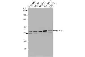 WB Image Various whole cell extracts (30 μg) were separated by 7.