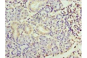 Immunohistochemistry of paraffin-embedded human pancreatic tissue using ABIN7169410 at dilution of 1:100 (SMYD4 antibody  (AA 1-260))