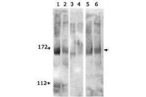 Expression of FancD2 (mAb) in different cell lines : proliferating cells were treated with IR or kept as mock of IR.
