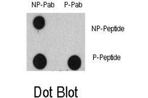 Image no. 1 for anti-Epidermal Growth Factor Receptor (EGFR) (pTyr1125) antibody (ABIN358328)