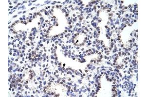 WNT2B antibody was used for immunohistochemistry at a concentration of 4-8 ug/ml to stain Alveolar cells (arrows) in Human Lung. (WNT2B antibody  (Middle Region))