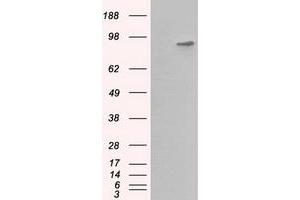 Western Blotting (WB) image for anti-Betaine--Homocysteine S-Methyltransferase (BHMT) antibody (ABIN1496916) (BHMT antibody)