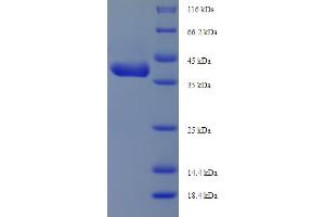 SDS-PAGE (SDS) image for Insulin-Like Growth Factor Binding Protein 1 (IGFBPI) (AA 26-272) protein (His-SUMO Tag) (ABIN5709727)