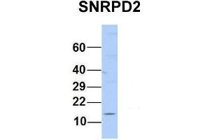 Host:  Rabbit  Target Name:  SNRPD2  Sample Type:  Human MCF7  Antibody Dilution:  1. (SNRPD2 antibody  (N-Term))