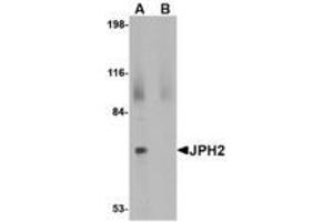 Image no. 1 for anti-Junctophilin 2 (JPH2) (C-Term) antibody (ABIN341698) (Junctophilin 2 antibody  (C-Term))