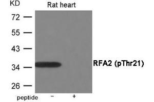 Western blot analysis of extracts from Rat heart using RFA2 (Phospho-Thr21) Antibody. (RPA2 antibody  (pThr21))