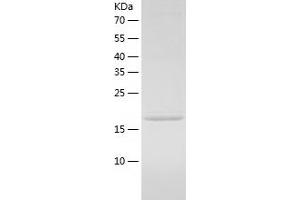 Western Blotting (WB) image for Ras-Related C3 Botulinum Toxin Substrate 3 (Rho Family, Small GTP Binding Protein Rac3) (RAC3) (AA 1-189) protein (His tag) (ABIN7124791) (RAC3 Protein (AA 1-189) (His tag))