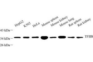 Western blot analysis of tfiib (ABIN7074034) at dilution of 1: 500 (GTF2B antibody)