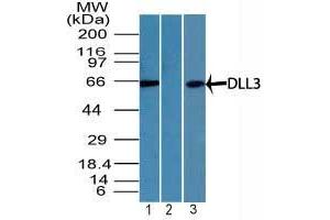 Image no. 1 for anti-delta Like Protein 3 (DLL3) (AA 100-150) antibody (ABIN960134) (DLL3 antibody  (AA 100-150))