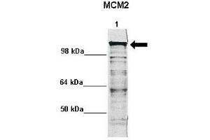 WB Suggested Anti-MCM2 Antibody    Positive Control:  Lane 1: 5ug mouse neural stem cell lysate  Primary Antibody Dilution :   1:1000  Secondary Antibody :  Anti rabbit - IR-dye  Secondry Antibody Dilution :   1:10,000   Submitted by:  Anonymous
