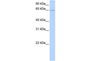 Western Blotting (WB) image for anti-Zinc Finger Protein 526 (ZNF526) antibody (ABIN2463451) (ZNF526 antibody)