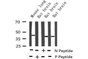 Western blot analysis of Phospho-MEK2 (Thr394) expression in various lysates (MEK2 antibody  (pThr394))