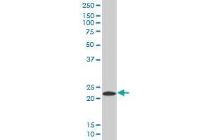PYCARD MaxPab polyclonal antibody. (PYCARD antibody  (AA 1-149))