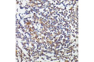 Immunohistochemistry of paraffin-embedded human colon using CSF3 antibody (ABIN6127710, ABIN6139100, ABIN6139101 and ABIN6221772) at dilution of 1:100 (40x lens). (G-CSF antibody  (AA 30-207))