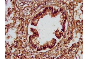 IHC image of ABIN7170440 diluted at 1:200 and staining in paraffin-embedded human lung tissue performed on a Leica BondTM system. (SPTBN1 antibody  (AA 2096-2256))