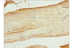 Immunohistochemistry of paraffin-embedded human skeletal muscle tissue using ABIN7175708 at dilution of 1:100 (WIPI2 antibody  (AA 205-454))