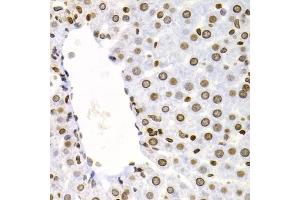 Immunohistochemistry of paraffin-embedded rat liver using NFKB2 Antibody (ABIN5971590) at dilution of 1/100 (40x lens). (NFKB2 antibody)